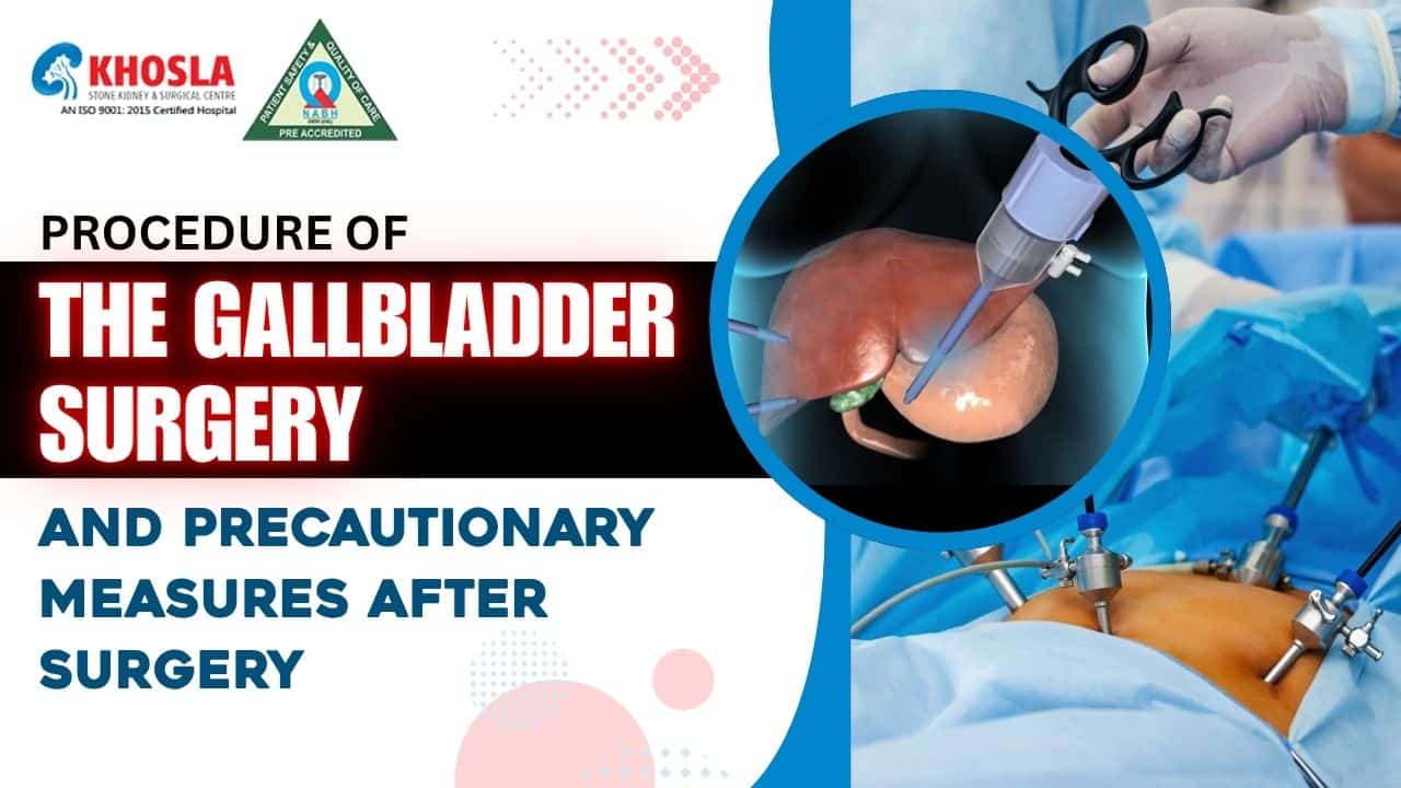 Procedure of the gallbladder surgery and precautionary measures after surgery