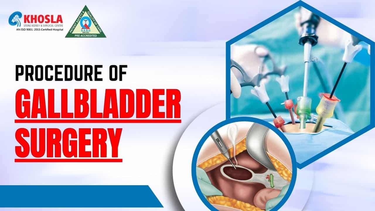 Procedure of the gallbladder surgery and precautionary measures after surgery | Khosla Stone Kidney & Surgical Centre