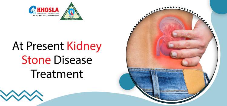 What are the causes of kidney stones, and how they are treated?