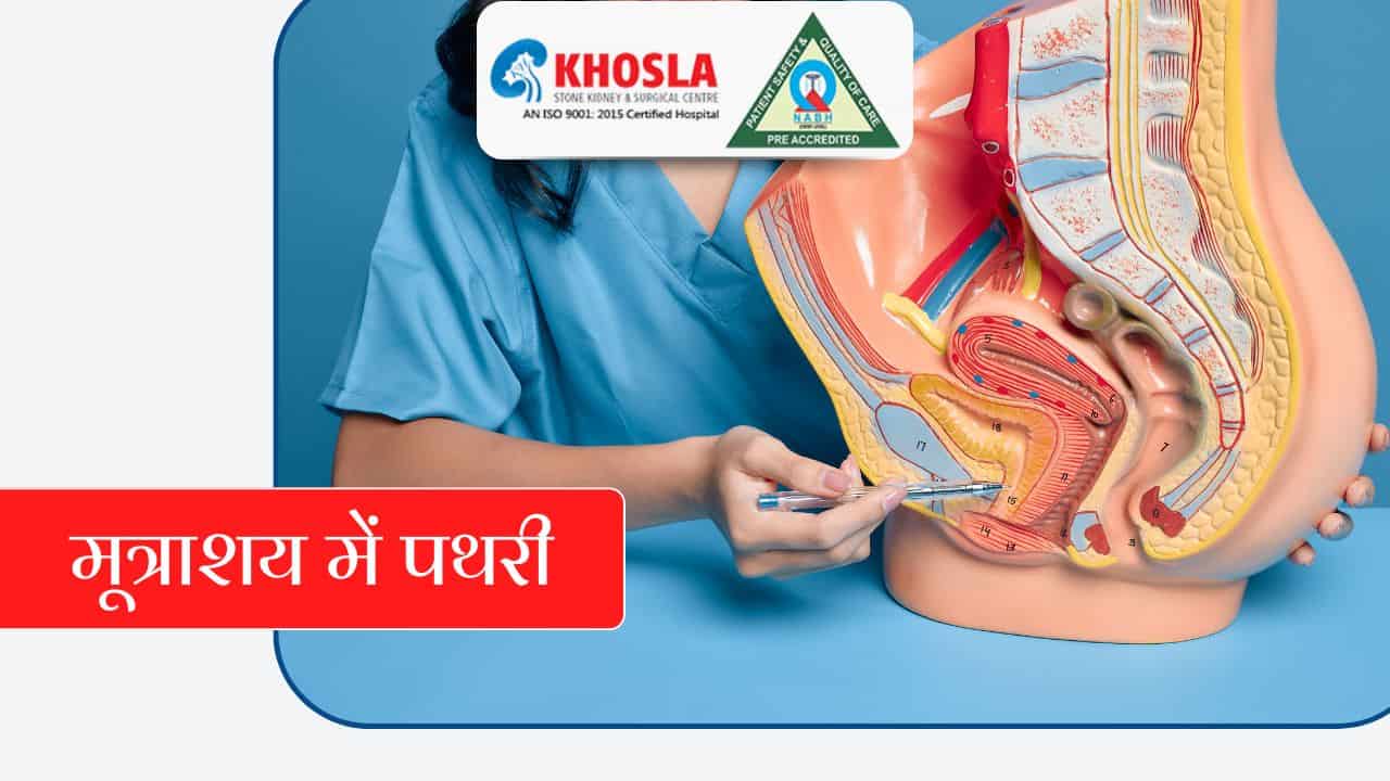 विशेषज्ञों से जाने, किन स्थितियों में पेशाब निकालने वाली नली की जरूरत पड़ती है? | Khosla Stone Kidney & Surgical Centre