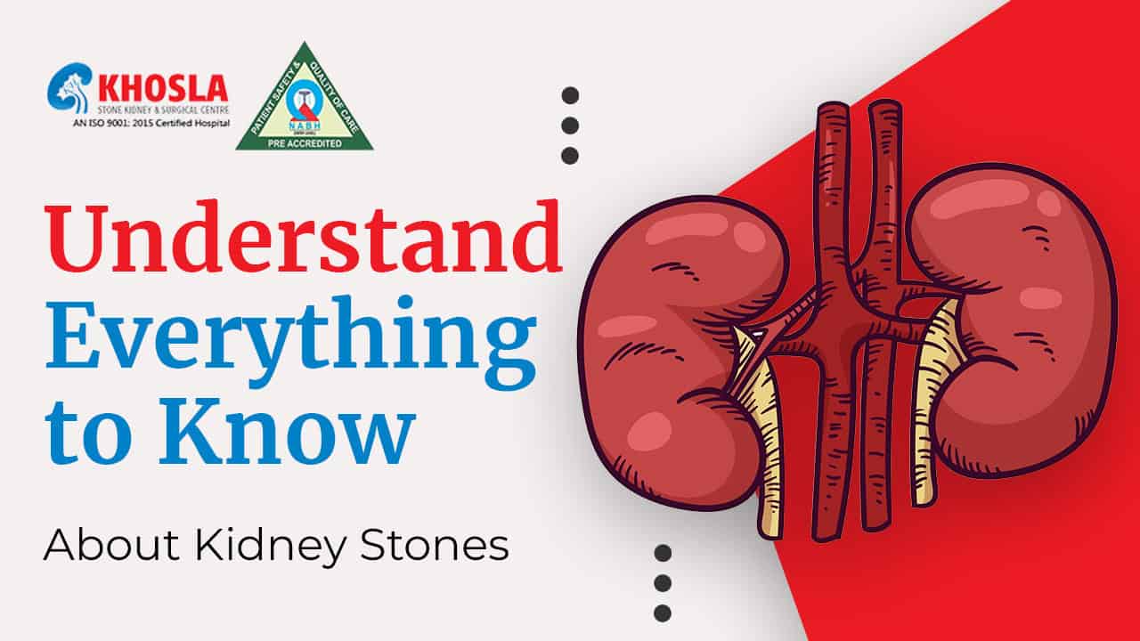 Understand Everything to Know About Kidney Stones