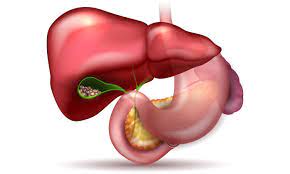 Gall Bladder Stones: What Foods to Avoid and Which to Embrace
