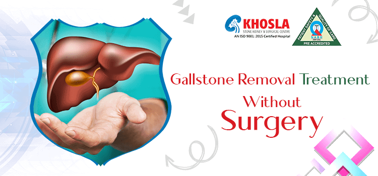 How to get a gallbladder stone removed without undergoing surgery?