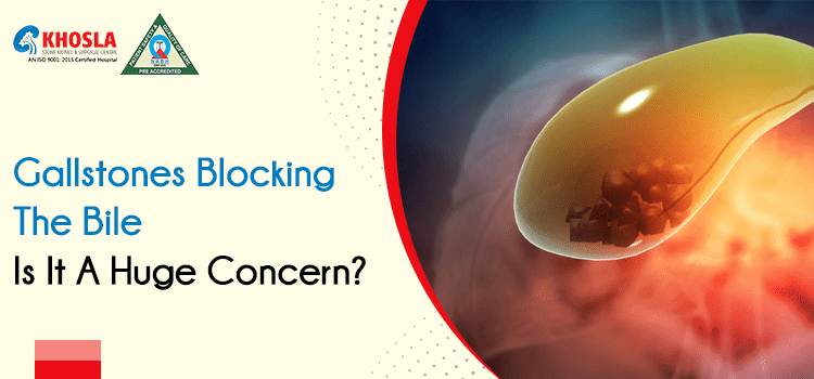 Gallstones blocking the bile: What is the gallstone treatment?