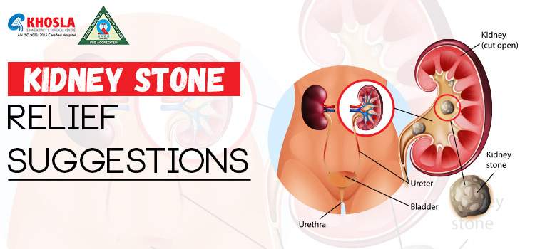 What is a Kidney cyst?