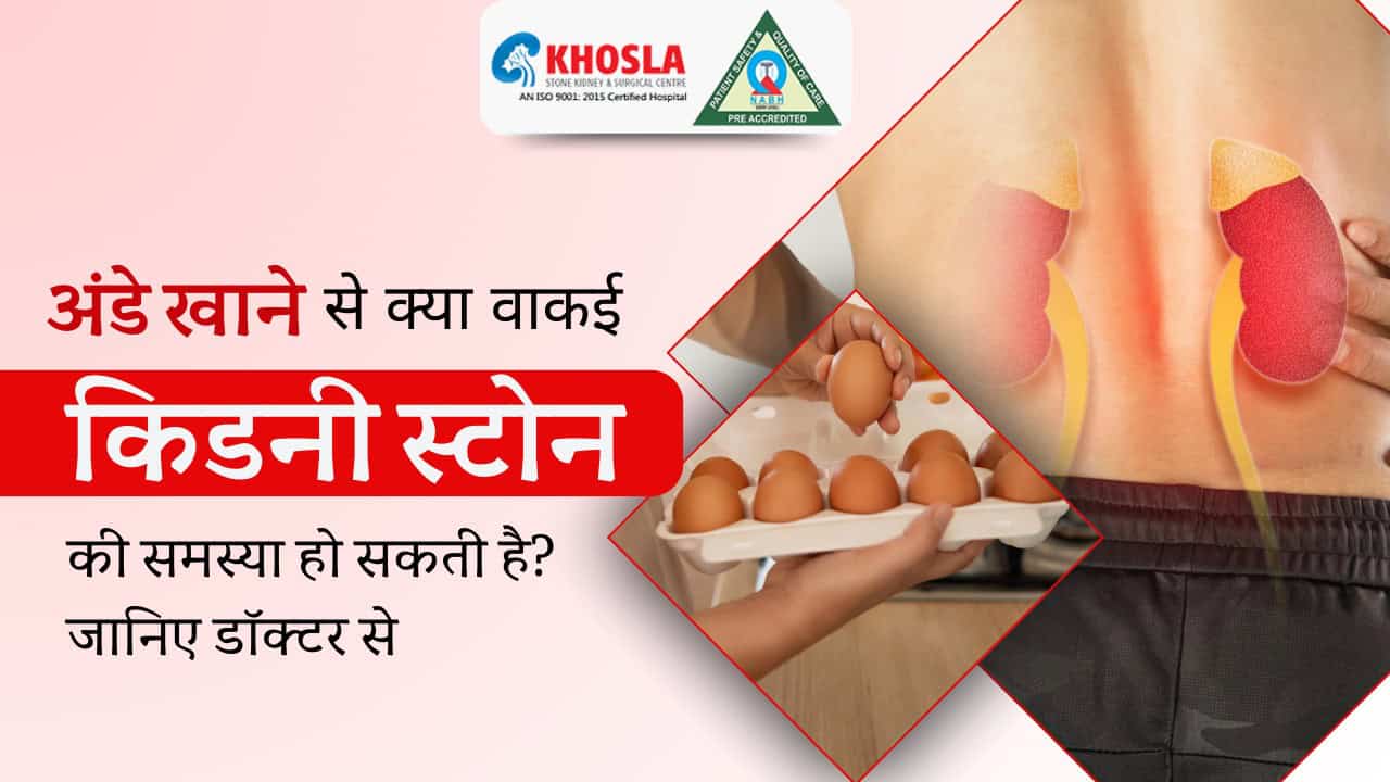 अंडे खाने से क्या वाकई किडनी स्टोन की समस्या हो सकती है? जानिए डॉक्टर से