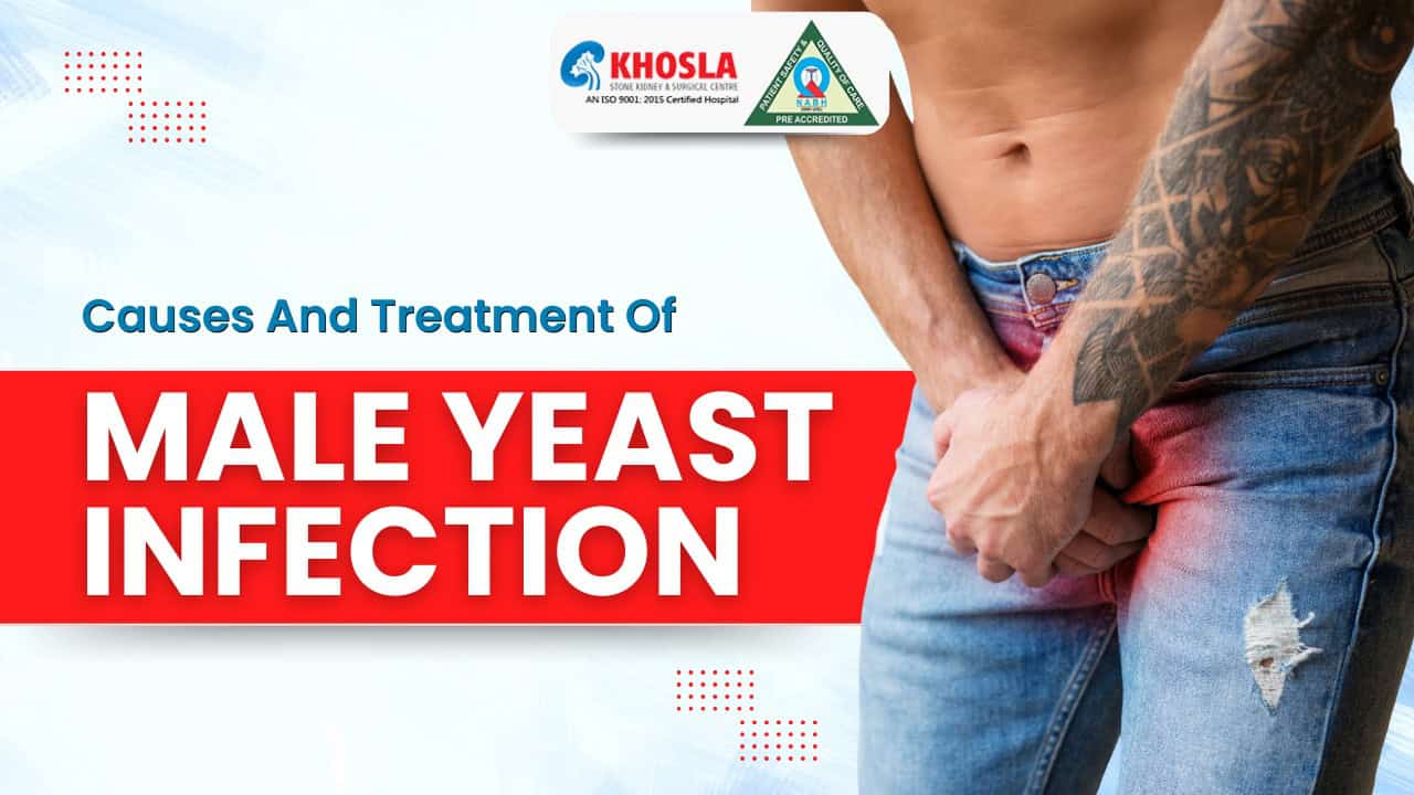 Causes And Treatment Of Male Yeast Infection.