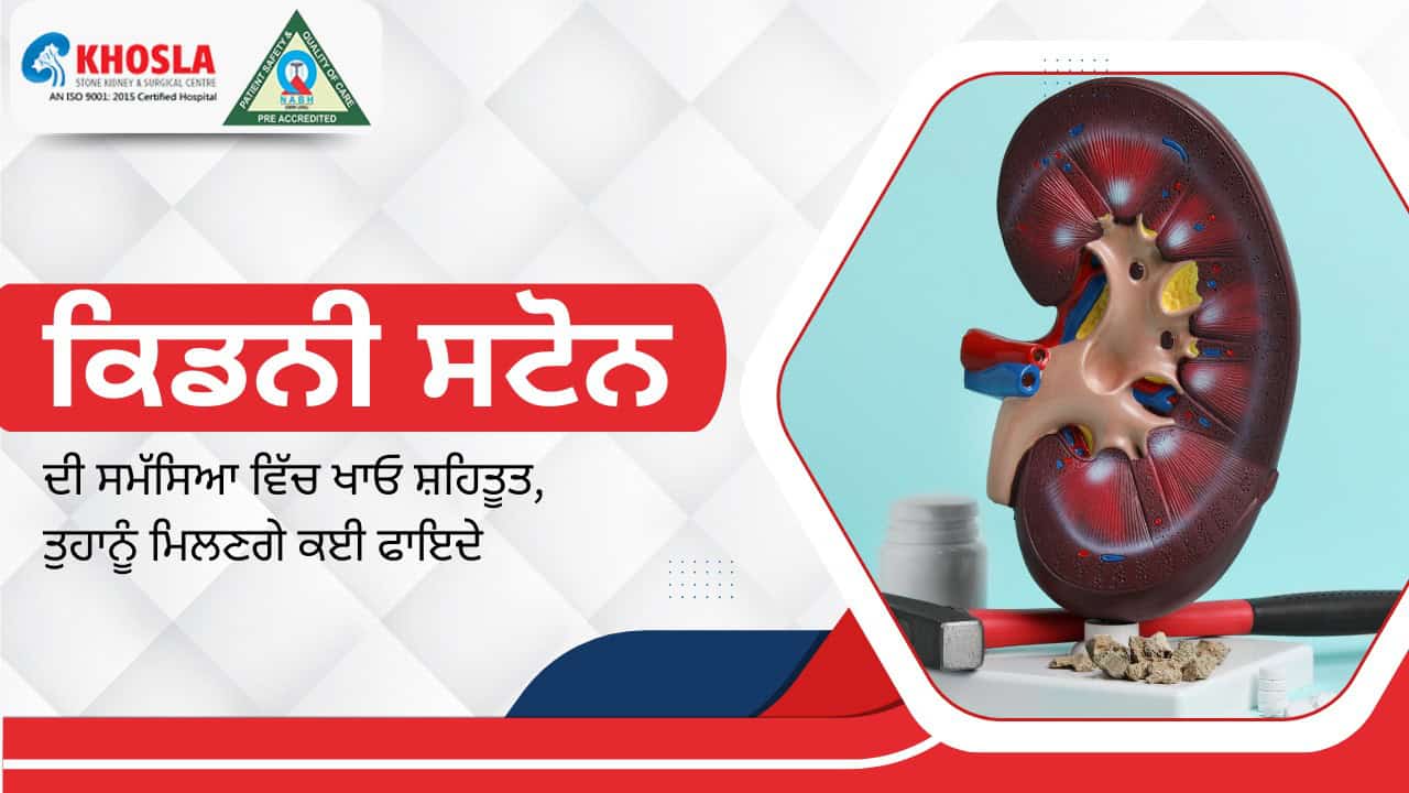 ਕਿਡਨੀ ਸਟੋਨ ਦੀ ਸਮੱਸਿਆ ਵਿੱਚ ਖਾਓ ਸ਼ਹਿਤੂਤ, ਤੁਹਾਨੂੰ ਮਿਲਣਗੇ ਕਈ ਫਾਇਦੇ