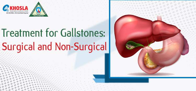 Gallstones Treatment Options: Surgical and Non-Surgical