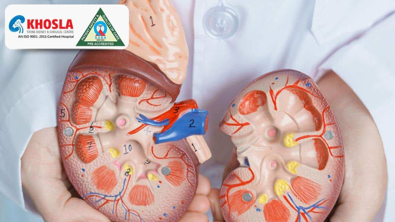 किडनी ट्रांसप्लांट क्या होता है, इसके जोखिम कारक, जटिलताएं और रिकवरी ? | Khosla Stone Kidney & Surgical Centre
