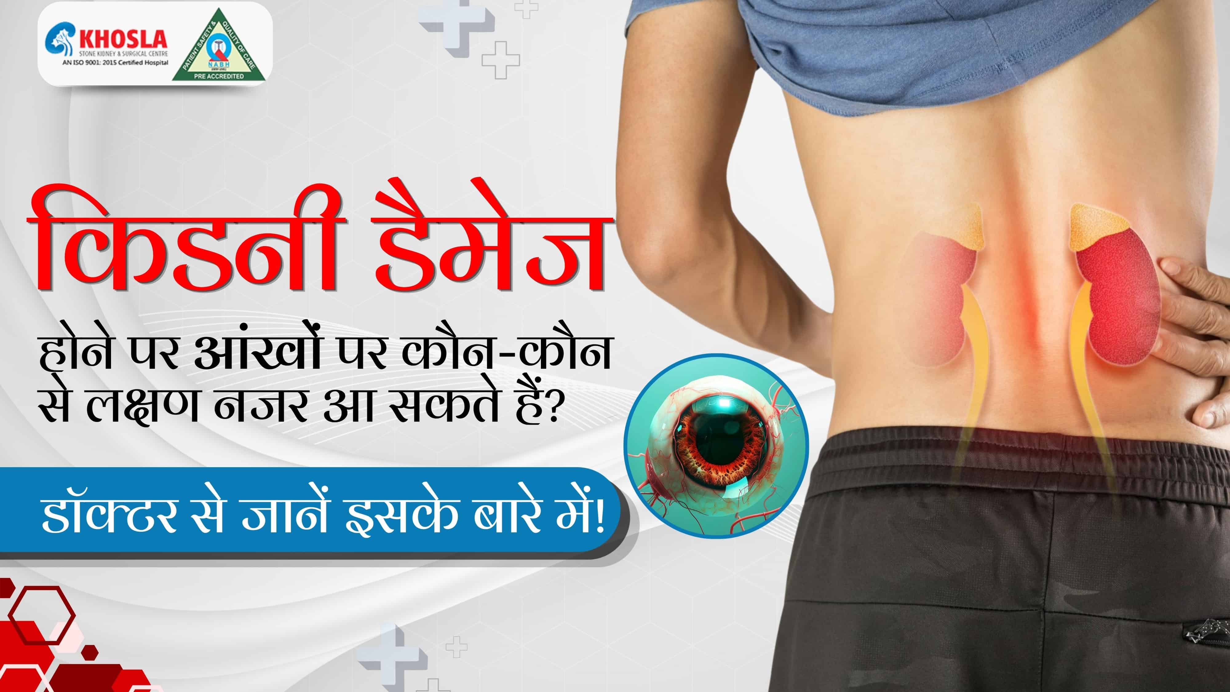 किडनी डैमेज होने पर आंखों पर कौन-कौन से लक्षण नजर आ सकते हैं? डॉक्टर से जानें इसके बारे में!
