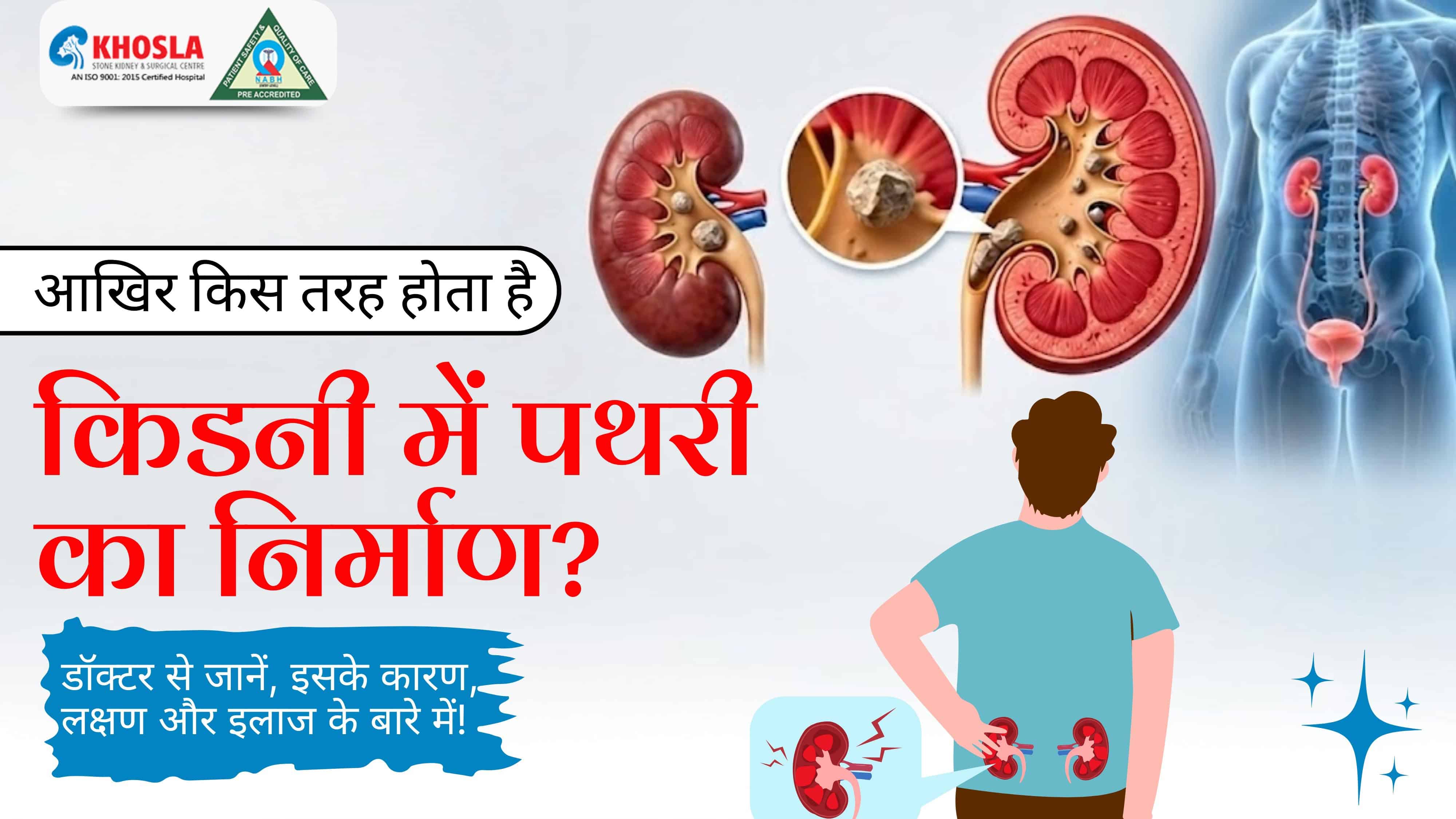 आखिर किस तरह होता है किडनी में पथरी का निर्माण? डॉक्टर से जानें, इसके कारण, लक्षण और इलाज के बारे में!
