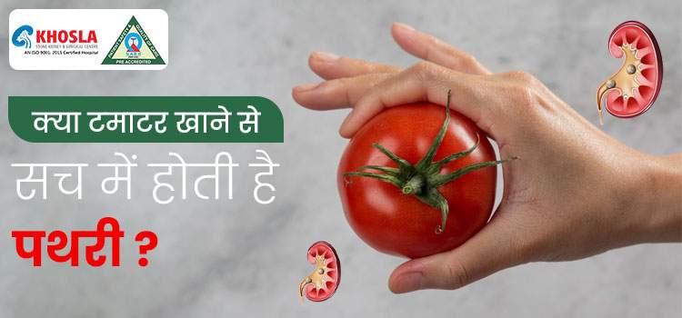 टमाटर खाने से पथरी होती है? जानें क्या है पूरा सच गुर्दे की पथरी के विशेषज्ञ से!