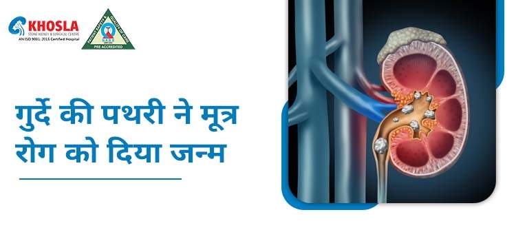 किडनी स्टोन या गुर्दे में पथरी, प्रकार, लक्षण, कारण और उपचार