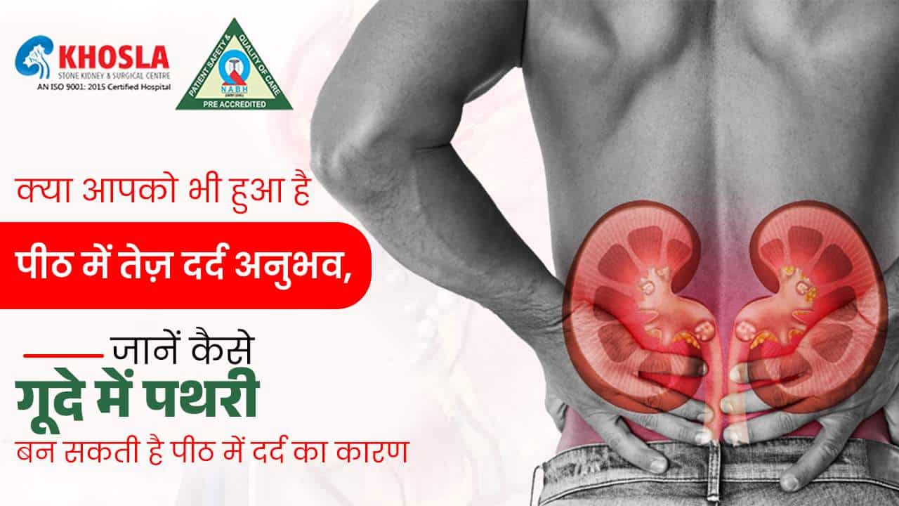 खोसला किडनी स्टोन एंड सर्जिकल सेंटर करता है किडनी स्टोन और मूत्रविज्ञान से पीड़ितों का सटीक इलाज