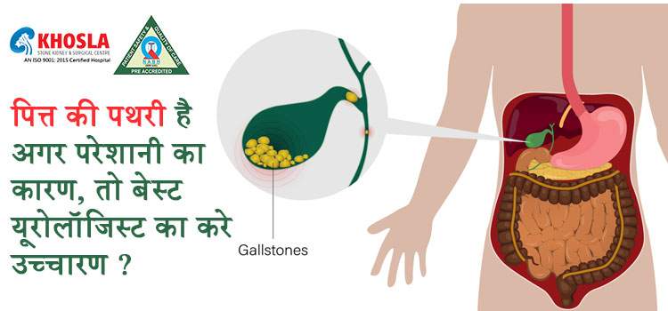 Cholelithiasis: बच्चों में पित्त की पथरी या (कोलेलिथियसिस) क्या है ?